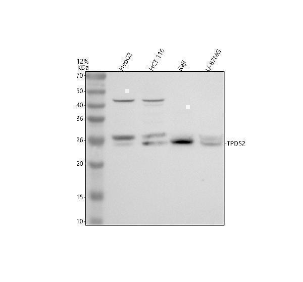 Western blot analysis of TPD52 using anti-TPD52 antibody (A03949-2)