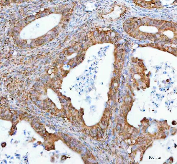 a03950 2 nup62 primary antibodies ihc testing 2