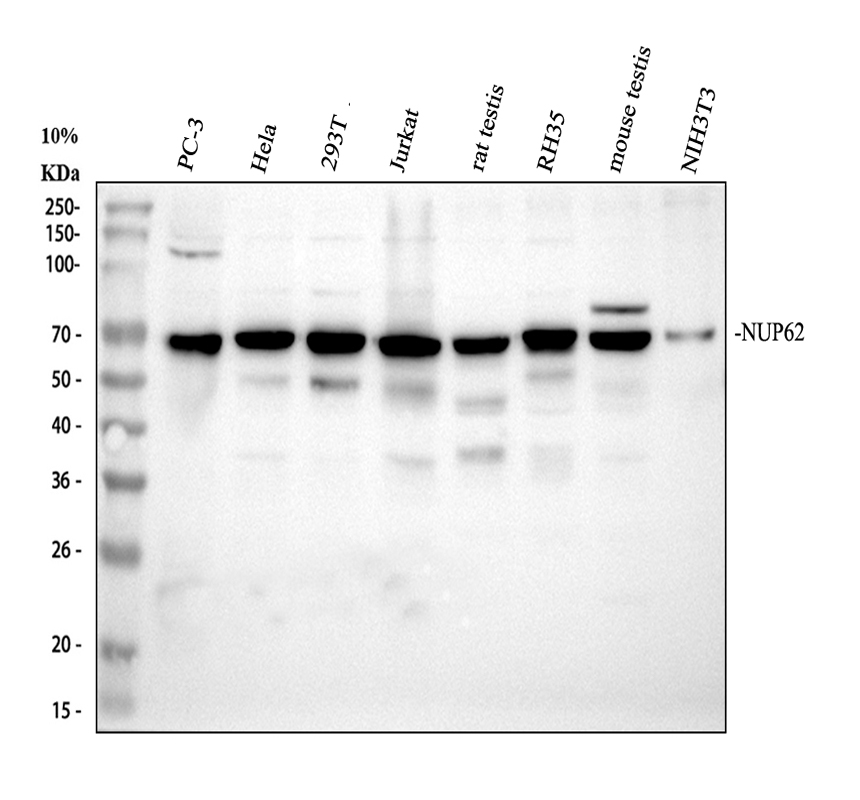 Western blot analysis of NUP62 using anti-NUP62 antibody (A03950-2)