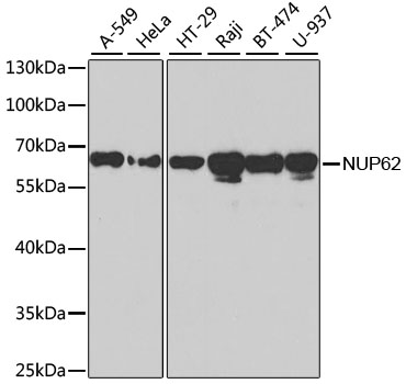 a03950 nup62 primary antiboties wb testing 1