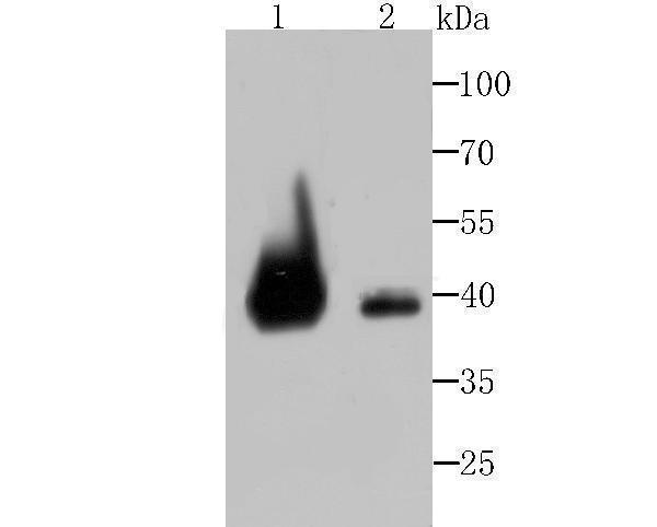 Western blot analysis of VPS26 on different cell lysates using anti-VPS26 at 1/500 dilution