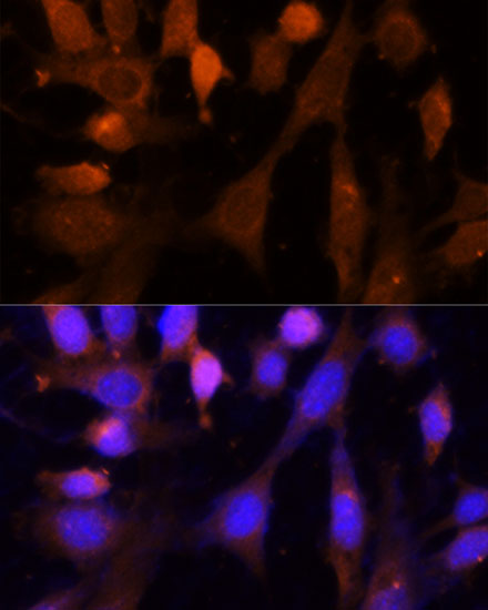 a03951 vps26a primary antiboties if testing 2