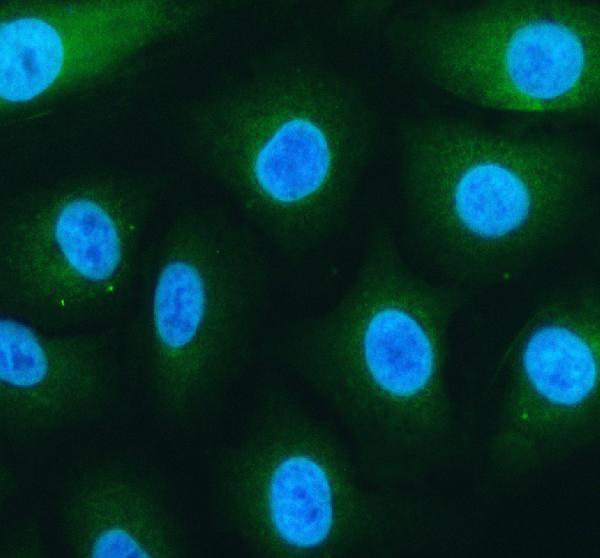a03954 3 cep55 primary antibodies if testing 1