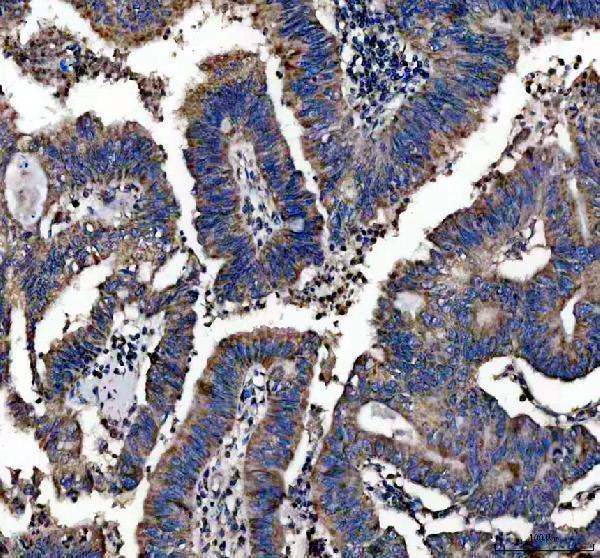 IHC analysis of CEP55 using anti-CEP55 antibody (A03954-3)