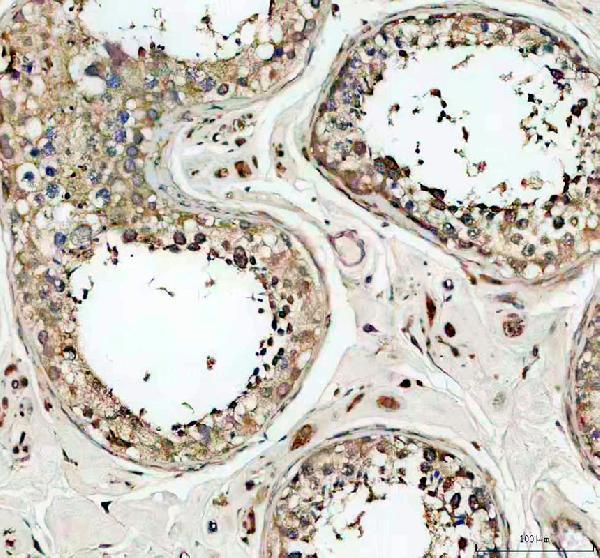 IHC analysis of CEP55 using anti-CEP55 antibody (A03954-3)