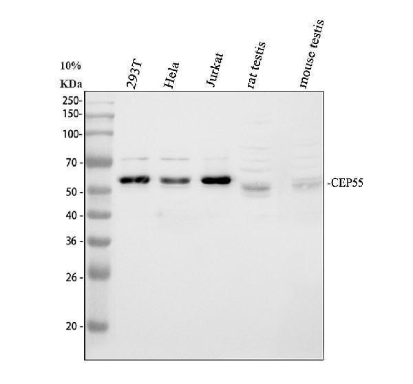 Western blot analysis of CEP55 using anti-CEP55 antibody (A03954-3)