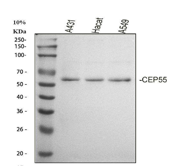  Western blot analysis of CEP55 using anti-CEP55 antibody (A03954-4)