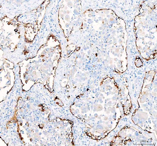 a03957 1 slc34a2 primary antibodies ihc testing 2