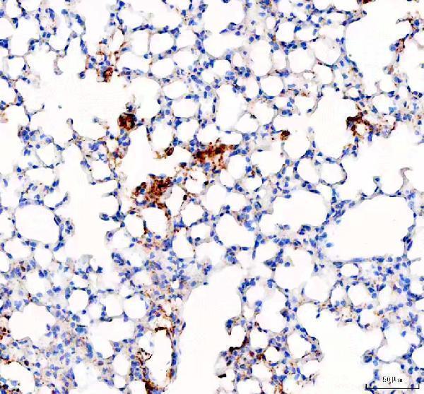 a03957 1 slc34a2 primary antibodies ihc testing 3