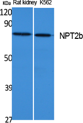 a03957 slc34a2 primary antibodies wb testing 1