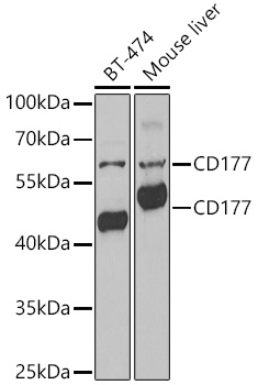 Western blot analysis of extracts of various lysates, using CD177 antibody  at 1:1000 dilution