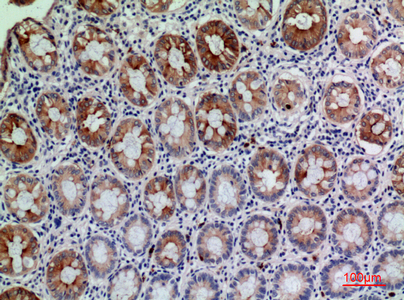 a03958 cd177 primary antibodies ihc testing 1