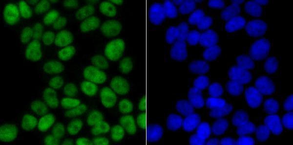 ICC staining p60 CAF1 in 293T cells (green)