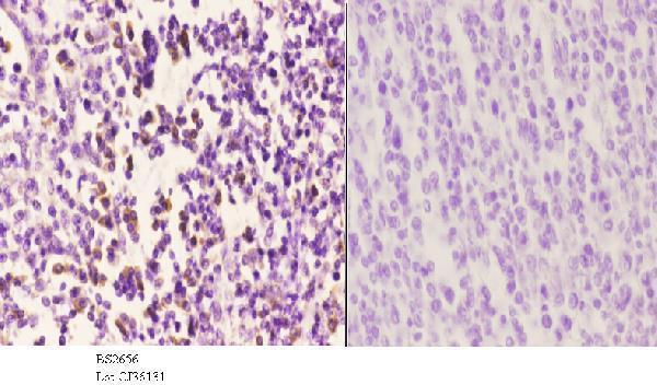 Immunohistochemistry (IHC) analyzes of CAF-1 p60 (W93) pAb in paraffin-embedded human tonsil carcinoma tissue at 1:50