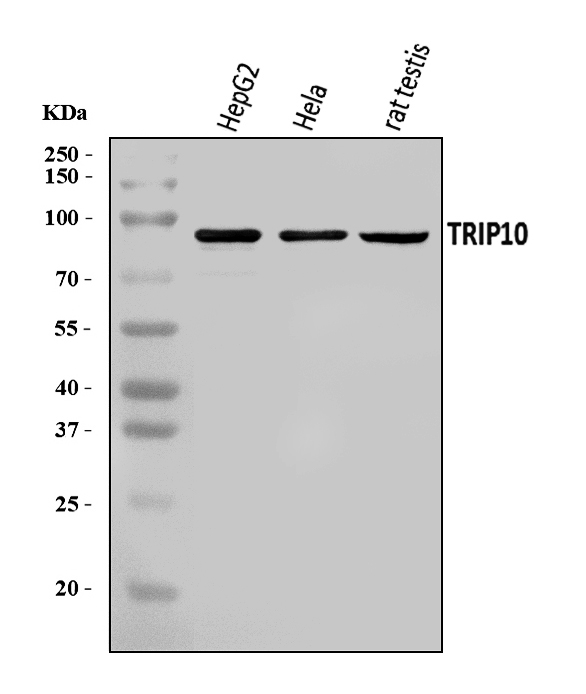 Western blot analysis of Cip4/TRIP10 using anti-Cip4/TRIP10 antibody (A03963-1)