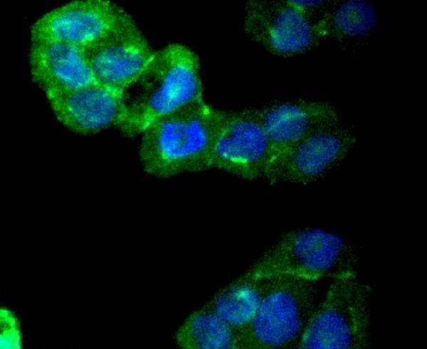 a03964 camk2b primary antiboties icc testing 2