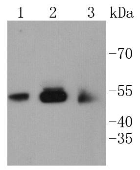 a03964 camk2b primary antiboties wb testing 1