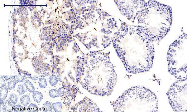 a03964t287 camk2b primary antibodyes ihc testing 10
