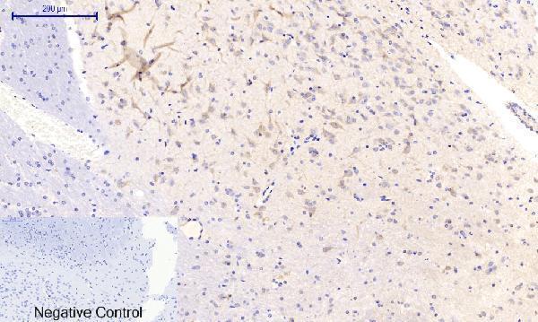 a03964t287 camk2b primary antibodyes ihc testing 11