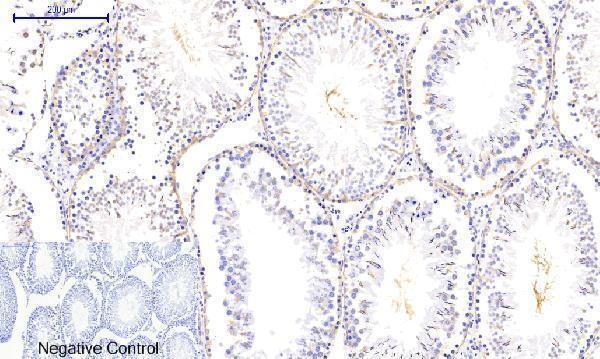 a03964t287 camk2b primary antibodyes ihc testing 15