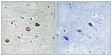 a03964t287 camk2b primary antibodyes ihc testing 16