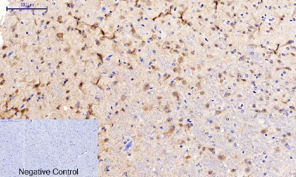 a03964t287 camk2b primary antibodyes ihc testing 6