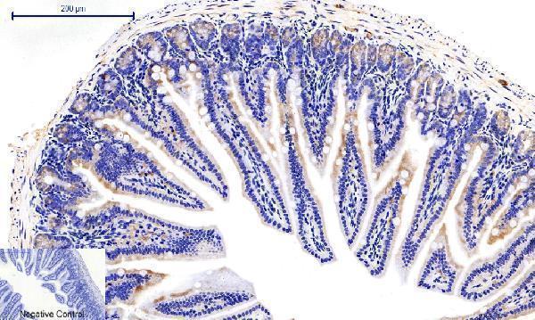 a03964t287 camk2b primary antibodyes ihc testing 7