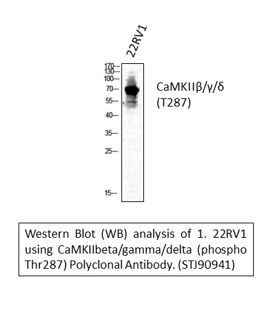a03964t287 camk2b primary antibodyes wb testing 1
