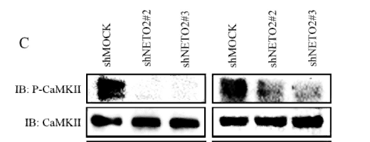 Western Blot analysis of 453 cells using Phospho-CaMKIIα/β/δ (T305) Polyclonal Antibody diluted at 1:1000
