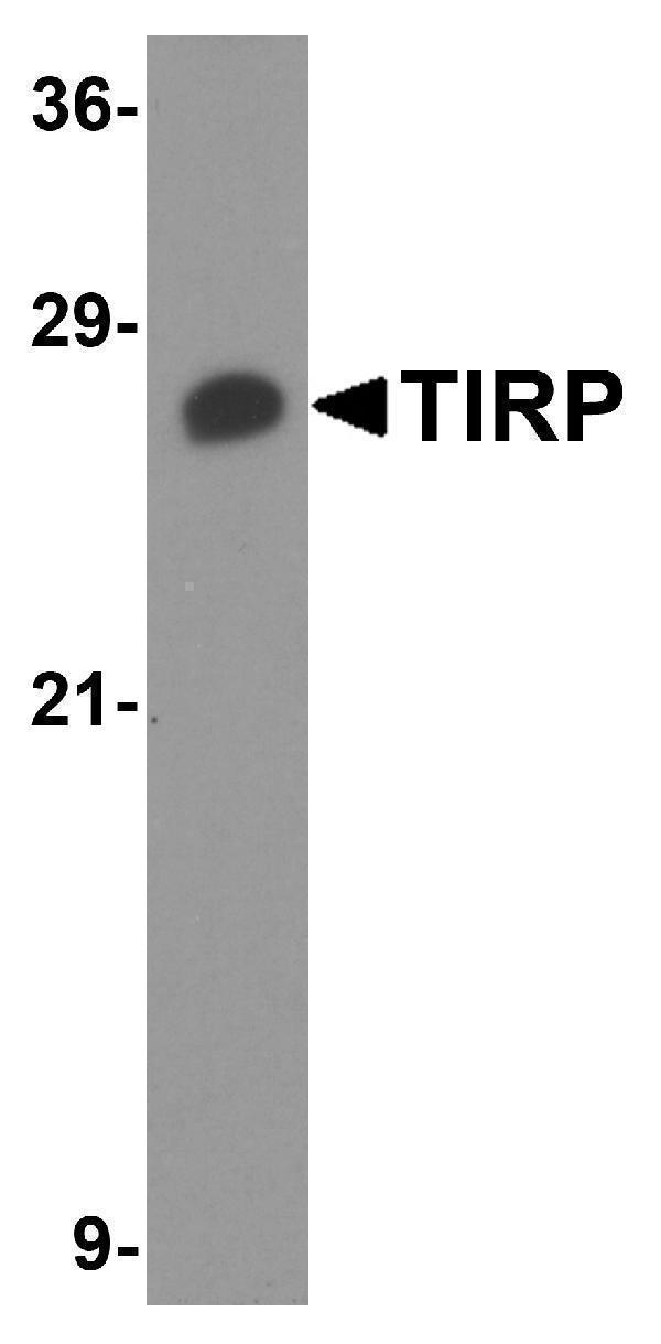 a03965 2 ticam2 primary antibodies wb testing 1