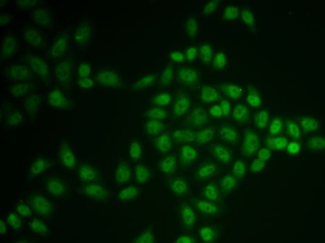 a03967 btg1 primary antiboties if testing 1