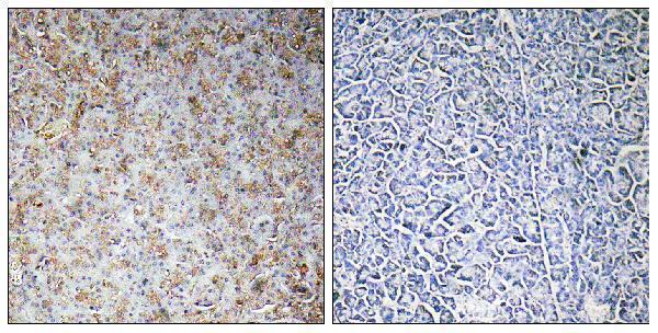 Immunohistochemistryt analysis of paraffin-embedded human pancreas, using WASF2 Antibody