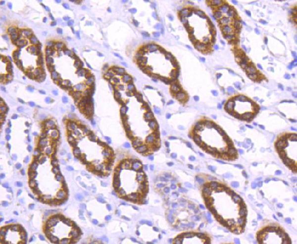 Immunohistochemical analysis of paraffin-embedded human kidney tissue using anti-WASF2 antibody