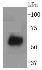 Western blot analysis of WASF2 on human placenta lysates using anti-WASF2 antibody at 1/1,000 dilution