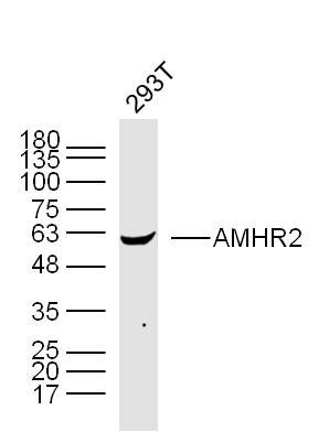a03970 amhr2 primary antiboties wb testing 1