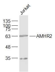 a03970 amhr2 primary antiboties wb testing 2