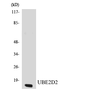 Western blot analysis of the lysates from K562 cells using UBE2D2 antibody