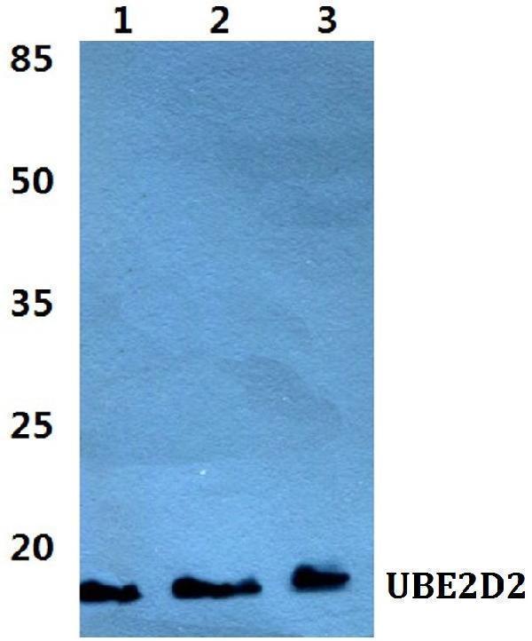 Western blot (WB) analysis of UBE2D2 polyclonal antibody at 1:500 dilution
Lane1:Hela cell lysate
Lane2:Raw264