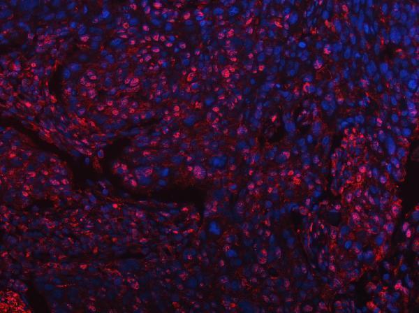 a03973 2 sart3 primary antibodies if testing 5_1