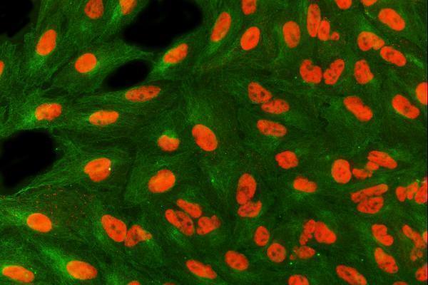 a03973 2 sart3 primary antibodies if testing 6