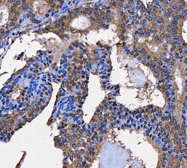  IHC analysis of SART3 using anti-SART3 antibody (A03973-2)