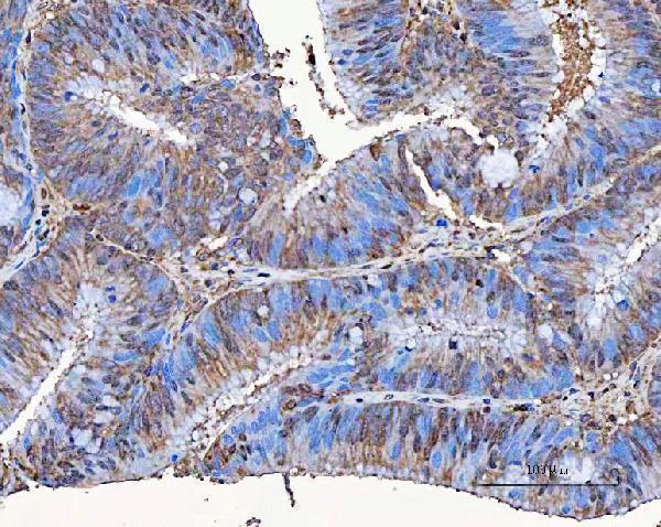  IHC analysis of SART3 using anti-SART3 antibody (A03973-2)