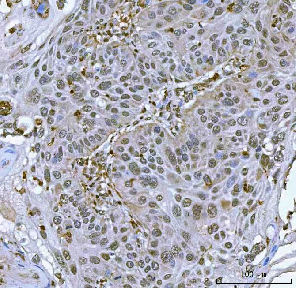 a03973 2 sart3 primary antibodies ihc testing 4
