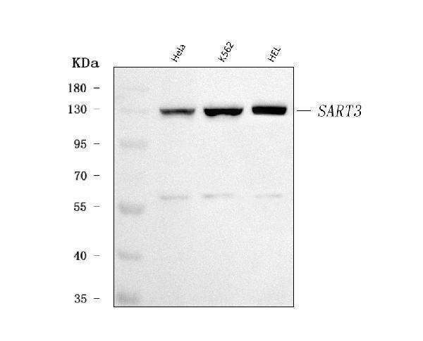  Western blot analysis of SART3 using anti-SART3 antibody (A03973-2)