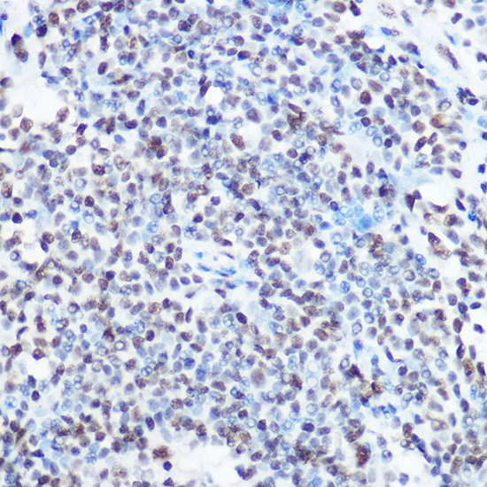 Immunohistochemistry of paraffin-embedded human lymph node using SART3 Rabbit pAb  at dilution of 1:100 