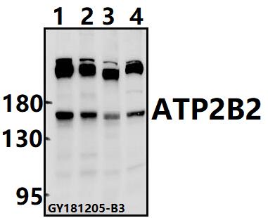 Western blot (WB) analysis of ATP2B2 pAb at 1:500 dilution
Lane1:A2780 whole cell lysate(40ug)
Lane2:L02 whole cell lysate(40ug)
Lane3:AML-12 whole cell lysate(40ug)
Lane4:C6 whole cell lysate(40ug)