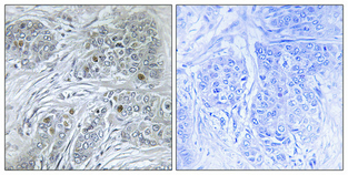 a03975 1 id4 primary antibodies ihc testing 1