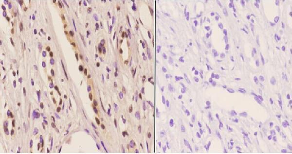 a03975s5 id4 primary antiboties ihc testing 2