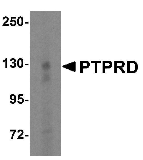a03977 ptprd primary antibodies wb testing 1