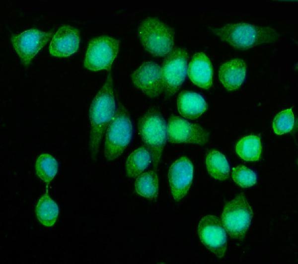 a03979 1 kif2a primary antibodies if testing 5
